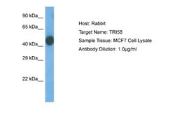 TRIM58 Antibody, Novus Biologicals 100 &mu;L; Unconjugated:Antibodies,